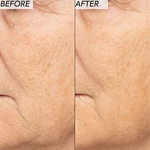 Nakery Beauty 2-Piece Supersize Firm + Lift Collection - Auto-Ship®