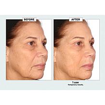 Nakery Beauty Advanced Instant Wrinkle Eraser Auto-Ship®