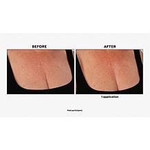 Nakery Beauty Firm + Wrinkle-Reducing Neck + Dec Serum
