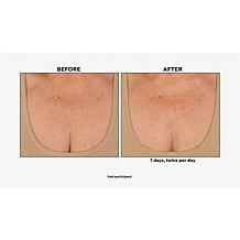 Nakery Beauty Firming Neck and Dec Serum & Magic Wand Set