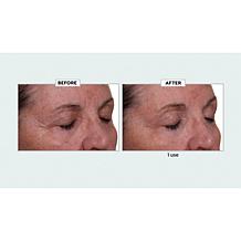 Nakery Beauty Lift-TOX 360 Firming Eye Lift Treatment Cream Auto-Ship®