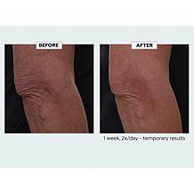 Nakery Beauty Lift-TOX Body Treatment Auto-Ship®