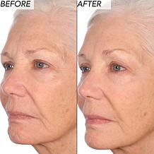 Nakery Beauty Lift-TOX Triple-Powered Define + Firm Serum