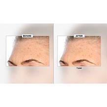 Nakery Beauty Peptide-Surge Intense Collagen Concentrate Auto-Ship®