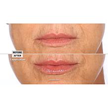 Nakery Beauty Plumping & Line-Smoothing Lip Treatment 3-pack