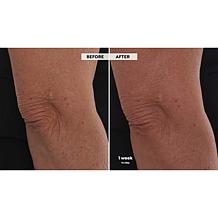 Nakery Beauty SkinRecovery Lift & Repair Body Cream Auto-Ship®