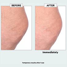 Nakery Beauty SkinRecovery Make it Vanish Power Cream w/Erase Complex