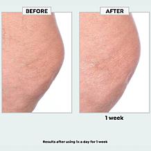 Nakery Beauty SkinRecovery Make it Vanish Power Cream w/Erase Complex