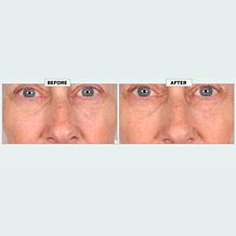 Nakery Beauty SkinRecovery Night Shift Concentrate - Auto-Ship®