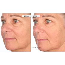 Nakery Beauty SkinRecovery Night Shift Concentrate - Auto-Ship®