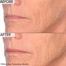 Nakery Beauty SkinRecovery The Age Edit TimeErasing Serum - Auto-Ship®