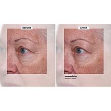 Nakery Beauty SkinRepair Retinol Deep Wrinkle Serum Auto-Ship®