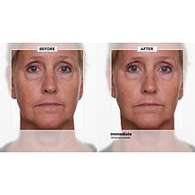 Nakery Beauty SkinRepair Retinol Wrinkle Serum