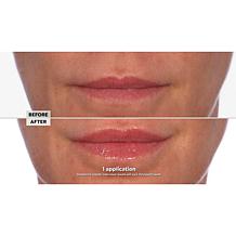 NassifMD 2-pack Pink Champagne Hydro-Screen for Lips Lip Plumper