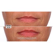 NassifMD 2-pack Pink Champagne Hydro-Screen for Lips Lip Plumper