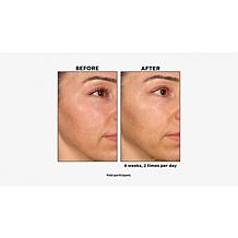 NassifMD 2-piece Dawn to Dusk Cleanser and Hydro-Gel Serum Set