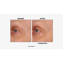 NassifMD® Age Defying Eye Renewal Serum with Dual Action Peptides