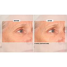 NassifMD Collagen Peptide Serum and Skincare Detox Pads Set