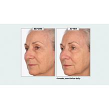 NassifMD Collagen Peptide Serum and Skincare Detox Pads Set