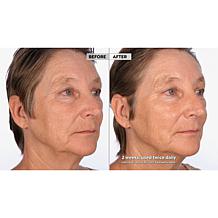 NassifMD® Detox Pads and Hydro-Screen® Face & Body Souffle Auto-Ship®