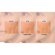 NassifMD Detox Pads and Hydro-Screen On-the-Go Set