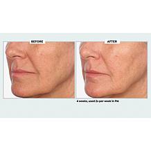 NassifMD Even & Correct Retexturizing Pads Home & Go Kit