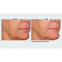 NassifMD Even & Correct Retexturizing Pads Home & Go Kit Auto-Ship®