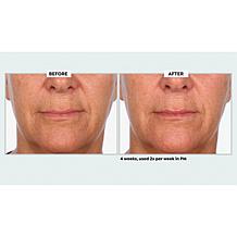 NassifMD Even & Correct Retexturizing Pads Home & Go Kit Auto-Ship®