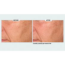 NassifMD Even, Correct & Renew Retexturizing Pads