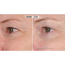 NassifMD Eye and Neck Targeted Peptide Try-Me 2-piece Set