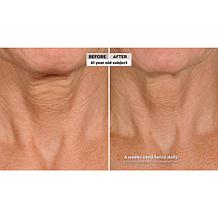 NassifMD Eye and Neck Targeted Peptide Try-Me 2-piece Set