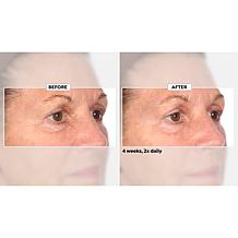 NassifMD Home and Go Niacinamide Biopeptide Serums