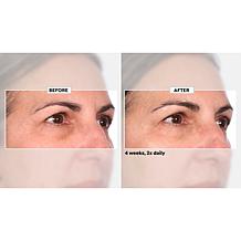 NassifMD Home and Go Niacinamide Biopeptide Serums
