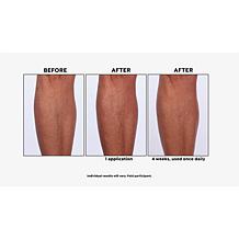 NassifMD® Hydro-Screen® Face & Body Souffle