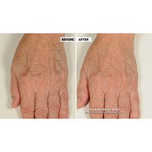 NassifMD® Hydro-Screen Hydrating Serum - Deluxe Size