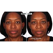 NassifMD® Hydro-Screen Hydrating Serum - Deluxe Size