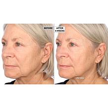 NassifMD Hydro-Screen Hydrating Serum Home & Go 2-piece Set