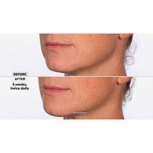 NassifMD Hydro-Screen Hydrating Serum Home & Go 2-piece Set