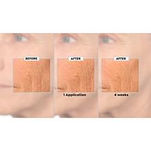 NassifMD Hydro-Screen Hydrating Serum Home & Go 2-piece Set Auto-Ship®