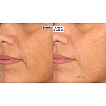 NassifMD Hydro-Screen Serum w/Hyaluronic Acid, Retinol & Ceramides AS