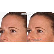 NassifMD Hydro-Screen Serum with Hyaluronic Acid, Retinol & Ceramides