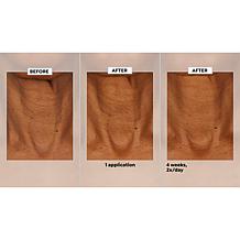 NassifMD Neck & Decollete Upfinity Peptide Complex Serum Auto-Ship®