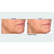 NassifMD Niacinamide Biopeptide Smoothing Serum