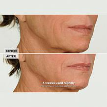 NassifMD Night Therapy Serum