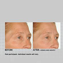 NassifMD Night Therapy Serum with Vitamin C & Retinol