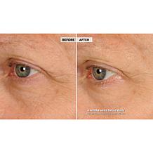 NassifMD Night Therapy Serum with Vitamin C & Retinol