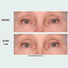 NassifMD Peptide-Infused Hydrating Face Mask and Eye Set