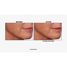 NassifMD® Pure Hydration Night Cream