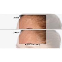 NassifMD Radiance Brightening Booster Serum w/ Vitamin C Auto-Ship®