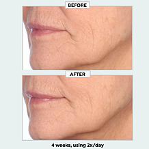 NassifMD Restore & Firm Face Oil with CoQ10